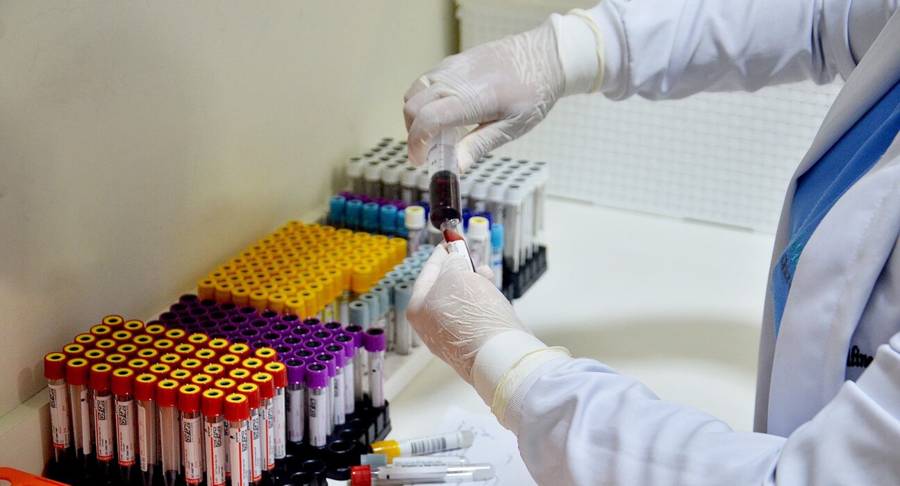 Unidades de Campina Grande atenderam cerca de 300 pacientes com exames laboratoriais, vacinação e outros serviços de saúde.